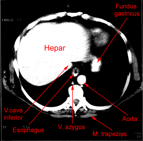 anatomia radiologiczna - 1.gif