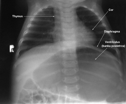 anatomia radiologiczna - 1.jpg