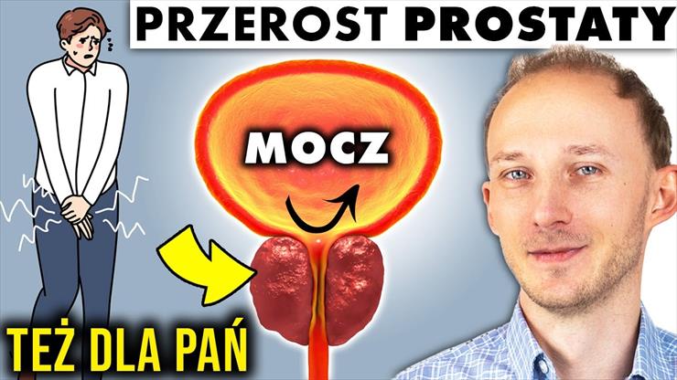10 metod na przerost prostaty Prostata_ ... - 10 metod na przerost prostaty Prostat...wy rozrostu _ Dr Bartek Kulczyński BQ.jpg