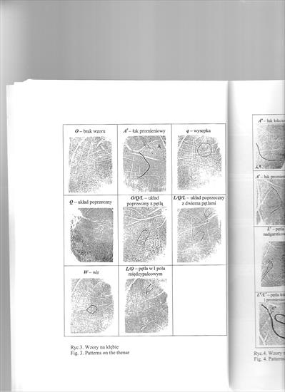 Buchwald Kompleksowa ocena asymetrii dermatoglifów - bScanImage005.jpg